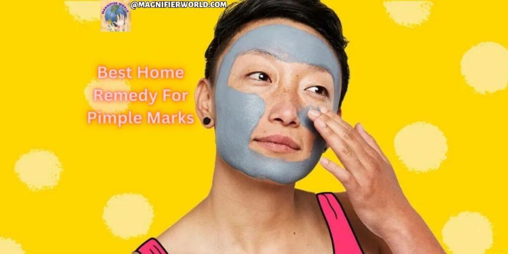 Best home remedy for pimple marks