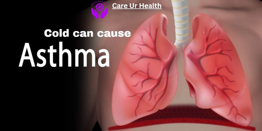 Cold can cause asthma: Understanding the Impact and Mitigating Risks