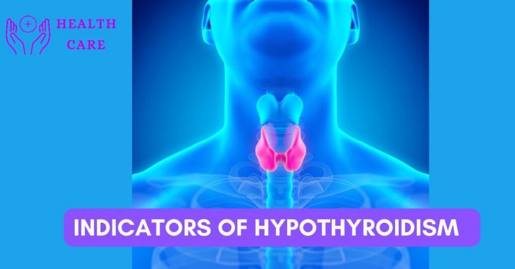 Indicators of hypothyroidism  