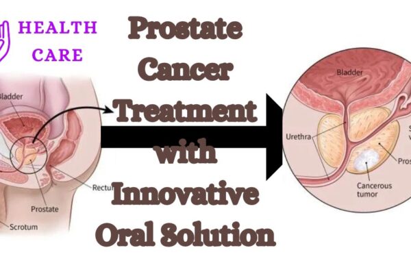 BDR Pharma Breakthrough: Revolutionizing Prostate Cancer Treatment with Innovative Oral Solution