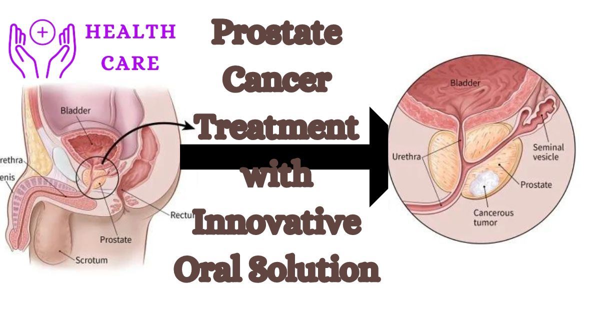 BDR Pharma Breakthrough: Revolutionizing Prostate Cancer Treatment with Innovative Oral Solution