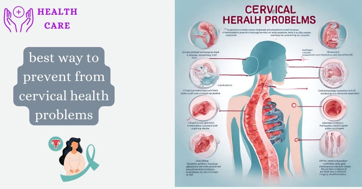 Cervical cancer: its prevention and symptoms  