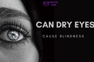 Know about eye problems: Can dry eyes cause blindness?