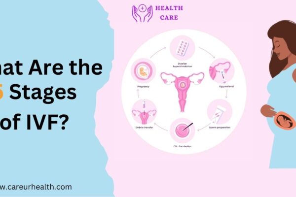 What Are thetop 5 Stages of IVF and How Do They Work?