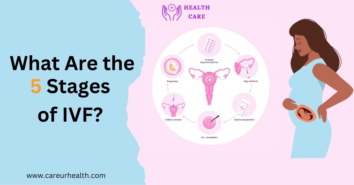 What Are thetop 5 Stages of IVF and How Do They Work?