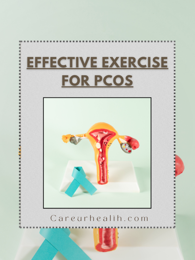 EFFECTIVE EXCERCISE FOR PCOS