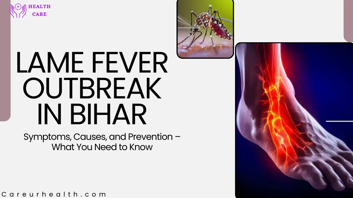 Lame Fever Outbreak in Bihar: Symptoms, Causes, and Prevention – What You Need to Know