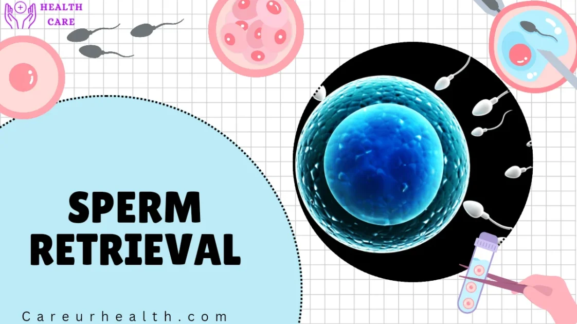 What Are thetop 5 Stages of IVF and How Do They Work?