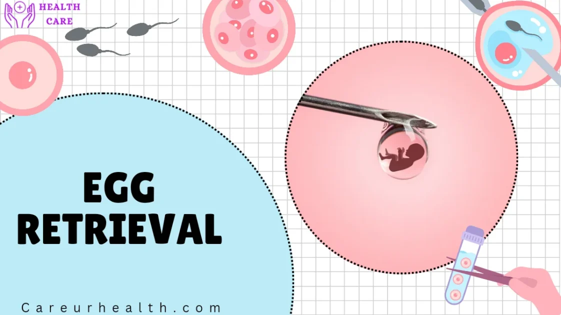 What Are thetop 5 Stages of IVF and How Do They Work?