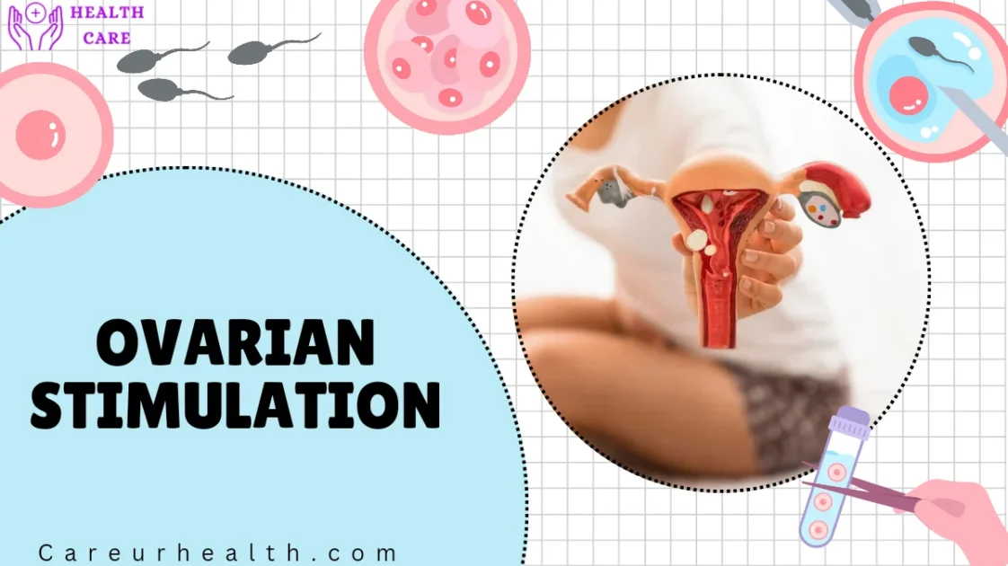 What Are thetop 5 Stages of IVF and How Do They Work?