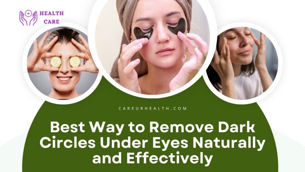 best way to remove dark circles under eyes