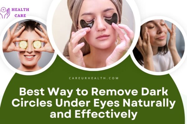 Best Way to Remove Dark Circles Under Eyes Naturally and Effectively